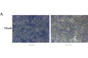 Immunohistochemistry (IHC) image for anti-Integrin alpha M (ITGAM) (AA 77-180) antibody (ABIN730918)