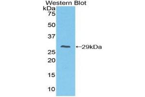 Western Blotting (WB) image for anti-Fc Fragment of IgG, High Affinity Ia, Receptor (CD64) (FCGR1A) (AA 73-294) antibody (ABIN7440284)
