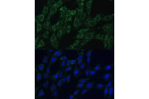 Immunofluorescence analysis of C6 cells using  Polyclonal Antibody (ABIN7265509) at dilution of 1:100 (40x lens). (AEBP1 Antikörper  (AA 999-1158))