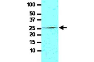 Cell lysate of Jurkat (30 ug) was resolved by SDS-PAGE and probed with FADD monoclonal antibody, clone J1D2  (1:500). (FADD Antikörper  (AA 1-208))