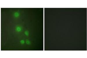 Immunofluorescence analysis of HUVEC cells, using ACL6A antibody.