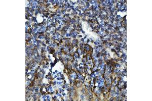 IHC analysis of GPCR RDC1/CXCR-7/ACKR3 using anti-GPCR RDC1/CXCR-7/ACKR3 antibody (ABIN7602889).
