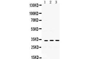 Western Blotting (WB) image for anti-Superoxide Dismutase 3, Extracellular (SOD3) (AA 37-75), (N-Term) antibody (ABIN3043936) (SOD3 Antikörper  (N-Term))