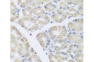 Immunohistochemistry of paraffin-embedded Human stomach using DISC1 Polyclonal Antibody at dilution of 1:100 (40x lens). (DISC1 Antikörper)
