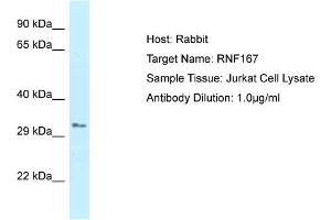 Host: Rabbit Target Name: RNF167 Sample Type: Jurkat Whole Cell lysates Antibody Dilution: 1. (RNF167 Antikörper  (C-Term))