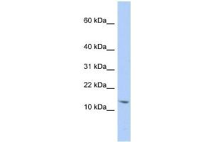 SNRPD2 antibody used at 1 ug/ml to detect target protein. (SNRPD2 Antikörper  (N-Term))