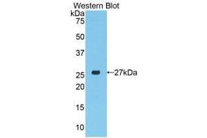 Western blot analysis of the recombinant protein. (PRTN3 Antikörper  (AA 24-249))