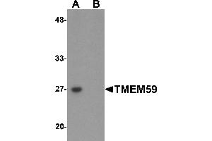 Western Blotting (WB) image for anti-Transmembrane Protein 59 (TMEM59) (N-Term) antibody (ABIN1031631) (TMEM59 Antikörper  (N-Term))