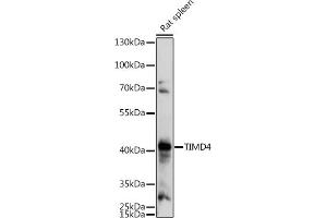 Western blot analysis of extracts of Rat spleen, using TIMD4 antibody (ABIN7270705) at 1:1000 dilution. (TIMD4 Antikörper  (AA 25-130))