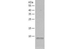 DYNLRB1 Protein (AA 1-96) (His tag)