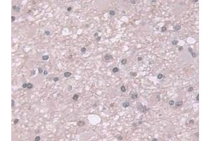 Immunohistochemistry (IHC) image for anti-Ubiquitin (Ub) (AA 1-229) antibody (ABIN7443803)