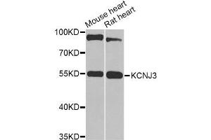 Western blot analysis of extracts of various cell lines, using KCNJ3 Antibody (ABIN6003556) at 1/1000 dilution. (KCNJ3 Antikörper)
