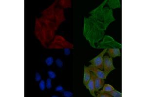 ABIN6257953 and ABIN6274909 staining Hela cells(30 min of UV treatment) by IF/ICC. (B4GALNT1 Antikörper  (Internal Region))