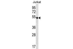 WDR40A Antibody (Center) western blot analysis in Jurkat cell line lysates (35 µg/lane).
