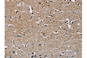The image on the left is immunohistochemistry of paraffin-embedded Human brain tissue using ABIN7130272(MSH5 Antibody) at dilution 1/30, on the right is treated with fusion protein. (MSH5 Antikörper)