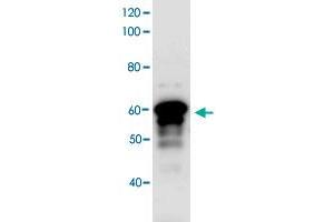 Western blot analysis bacterial lysate of MBP-fused antigen protein by using Myt1l polyclonal antibody (Cat. (MYT1L Antikörper)