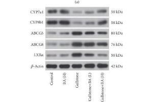 Lithogenic diet induced disorders of cholesterol synthesis and transport in liver. (ABCG5 Antikörper  (AA 350-450))