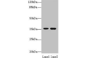 Western blot All lanes: EEF2KMT antibody at 6 μg/mL Lane 1: Hela whole cell lysate Lane 2: 293T whole cell lysate Secondary Goat polyclonal to rabbit IgG at 1/10000 dilution Predicted band size: 37, 34 kDa Observed band size: 37 kDa (EEF2KMT (AA 1-330) Antikörper)