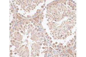 Immunohistochemistry of paraffin-embedded Mouse testis using VEGF Receptor 2 Polyclonal Antibody at dilution of 1:100 (40x lens). (VEGFR2/CD309 Antikörper)