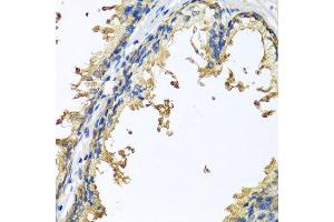 Immunohistochemistry of paraffin-embedded human prostate using NLGN4Y antibody at dilution of 1:100 (x40 lens). (Neuroligin Y Antikörper)