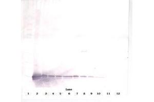 Image no. 2 for anti-gamma-Interferon-Induced Monokine (CXCL9) antibody (ABIN465877) (CXCL9 Antikörper)