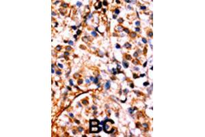 Immunohistochemistry (IHC) image for anti-Nuclear Factor kappa B (NFkB) (pSer536) antibody (ABIN3001768) (NFkB Antikörper  (pSer536))