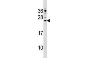 CAMP antibody western blot analysis in NCI-H292 lysate
