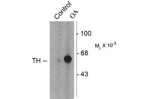 Image no. 1 for anti-Tyrosine Hydroxylase (TH) (pSer31) antibody (ABIN372737) (Tyrosine Hydroxylase Antikörper  (pSer31))
