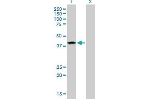 Western Blot analysis of ELAC1 expression in transfected 293T cell line by ELAC1 MaxPab polyclonal antibody. (ELAC1 Antikörper  (AA 1-363))