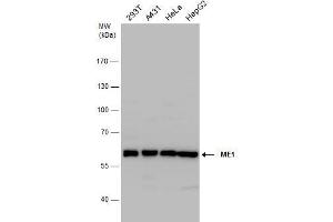 WB Image ME1 antibody detects ME1 protein by western blot analysis. (ME1 Antikörper)