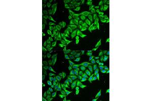Immunofluorescence (IF) image for anti-Death-Associated Protein (DAP) antibody (ABIN1877136) (DAP Antikörper)