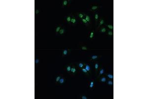 Immunofluorescence analysis of U-2 OS cells using TDP-43/TARDB Polyclonal Antibody (ABIN7270731) at dilution of 1:100 (40x lens). (TARDBP Antikörper  (AA 1-260))