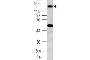 Image no. 1 for anti-NLR Family, Pyrin Domain Containing 3 (NLRP3) (AA 150-385) antibody (ABIN5027384) (NLRP3 Antikörper  (AA 150-385))