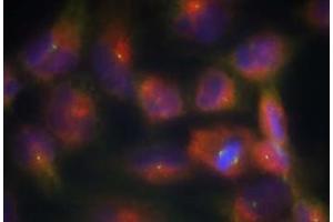 Image no. 1 for anti-Microtubule-Associated Protein tau (MAPT) (Ser356) antibody (ABIN401616)