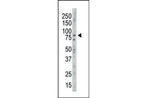 Image no. 1 for anti-NIMA (Never In Mitosis Gene A)-Related Kinase 11 (NEK11) (C-Term) antibody (ABIN360534) (NEK11 Antikörper  (C-Term))