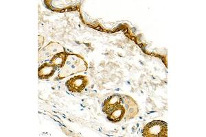 Immunohistochemistry (Paraffin-embedded Sections) (IHC (p)) image for anti-Keratin 13 (KRT13) (N-Term) antibody (ABIN7074412)
