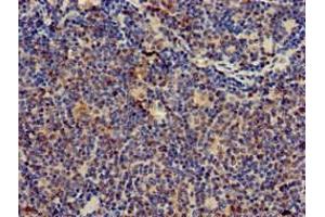 Immunohistochemistry of paraffin-embedded human lymph node tissue using ABIN7171394 at dilution of 1:100