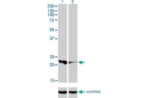 Western blot analysis of CAPS over-expressed 293 cell line, cotransfected with CAPS Validated Chimera RNAi (Lane 2) or non-transfected control (Lane 1). (Calcyphosine Antikörper  (AA 1-109))