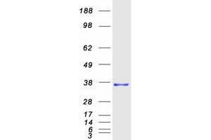 Validation with Western Blot (MMADHC Protein (Myc-DYKDDDDK Tag))