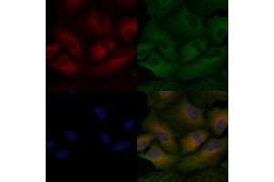 ABIN6259968 and ABIN6266497 staining  cells by IF/ICC. (APAF1 Antikörper  (C-Term))