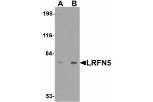 Image no. 1 for anti-Leucine Rich Repeat and Fibronectin Type III Domain Containing 5 (LRFN5) (C-Term) antibody (ABIN478054)
