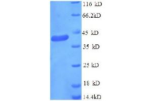 GABA(A) Receptor-Associated Protein (GABARAP) (AA 2-117), (partial) protein (GST tag) (GABARAP Protein (AA 2-117, partial) (GST tag))