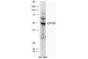 Mouse liver lysates probed with Anti-CYP7A1 Polyclonal Antibody, Unconjugated (ABIN739725) at 1:300 in 4˚C. (CYP7A1 Antikörper  (AA 351-400))