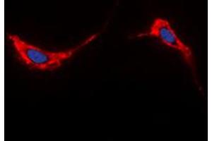 Immunofluorescent analysis of Aquaporin 2 staining in HeLa cells. (AQP2 Antikörper  (C-Term))