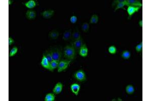 Immunofluorescent analysis of A431 cells using ABIN7158915 at dilution of 1:100 and Alexa Fluor 488-congugated AffiniPure Goat Anti-Rabbit IgG(H+L) (MFSD1 Antikörper  (AA 1-38))