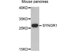 Western blot analysis of extracts of mouse pancreas, using SYNGR1 antibody. (Synaptogyrin 1 Antikörper)