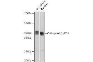 Western blot analysis of extracts of various cell lines, using Cathepsin L/V/K/H Rabbit mAb (ABIN7266150) at 1:1000 dilution. (Cathepsin L Antikörper)