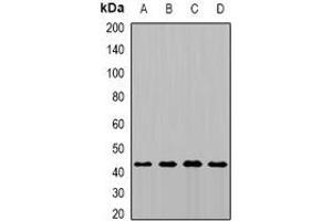 Western blot analysis of MTCH1 expression in MCF7 (A), HepG2 (B), mouse kidney (C), rat brain (D) whole cell lysates. (MTCH1 Antikörper)