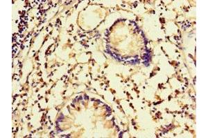 Immunohistochemistry of paraffin-embedded human appendix tissue using ABIN7152505 at dilution of 1:100 (FBXW5 Antikörper  (AA 265-494))