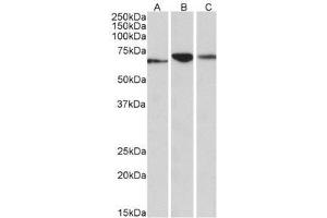 AP32138PU-N PDIA2 antibody staining of Human (A), Mouse (B) and Rat (C) Pancreas lysates (35µg protein in RIPA buffer) at 0. (PDIA2 Antikörper  (Internal Region))